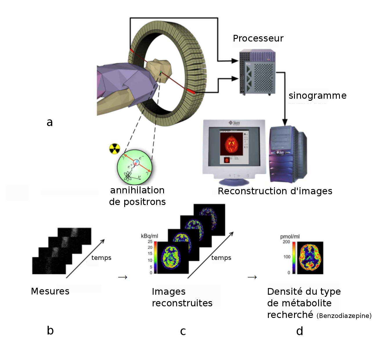 Tomographie par Emission de Positrons pour la détection de la densité d'un métabolite présent dans l'organisme