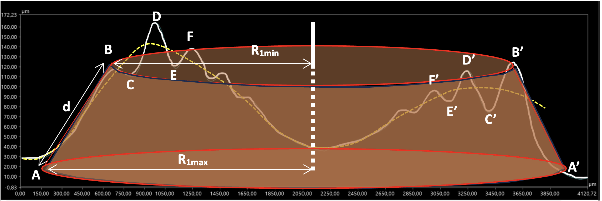 Découpe du profil des ondulations en un ensemble de cônes tronqués