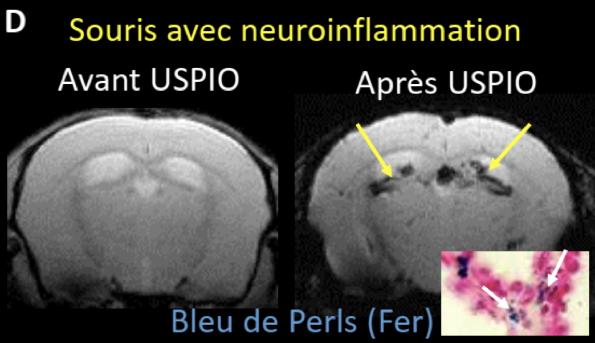 souris-neuroinflammation.png